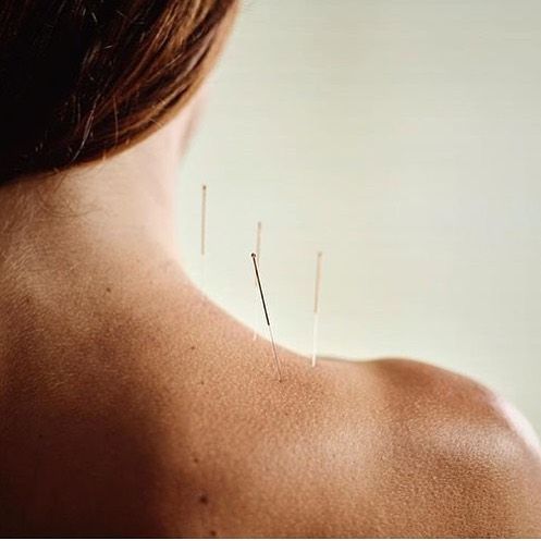 Acupuncture à Genève